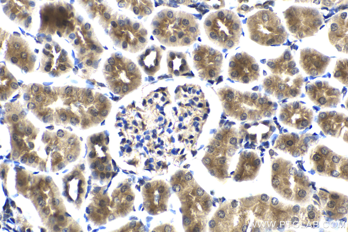 IHC staining of rat kidney using 25868-1-AP