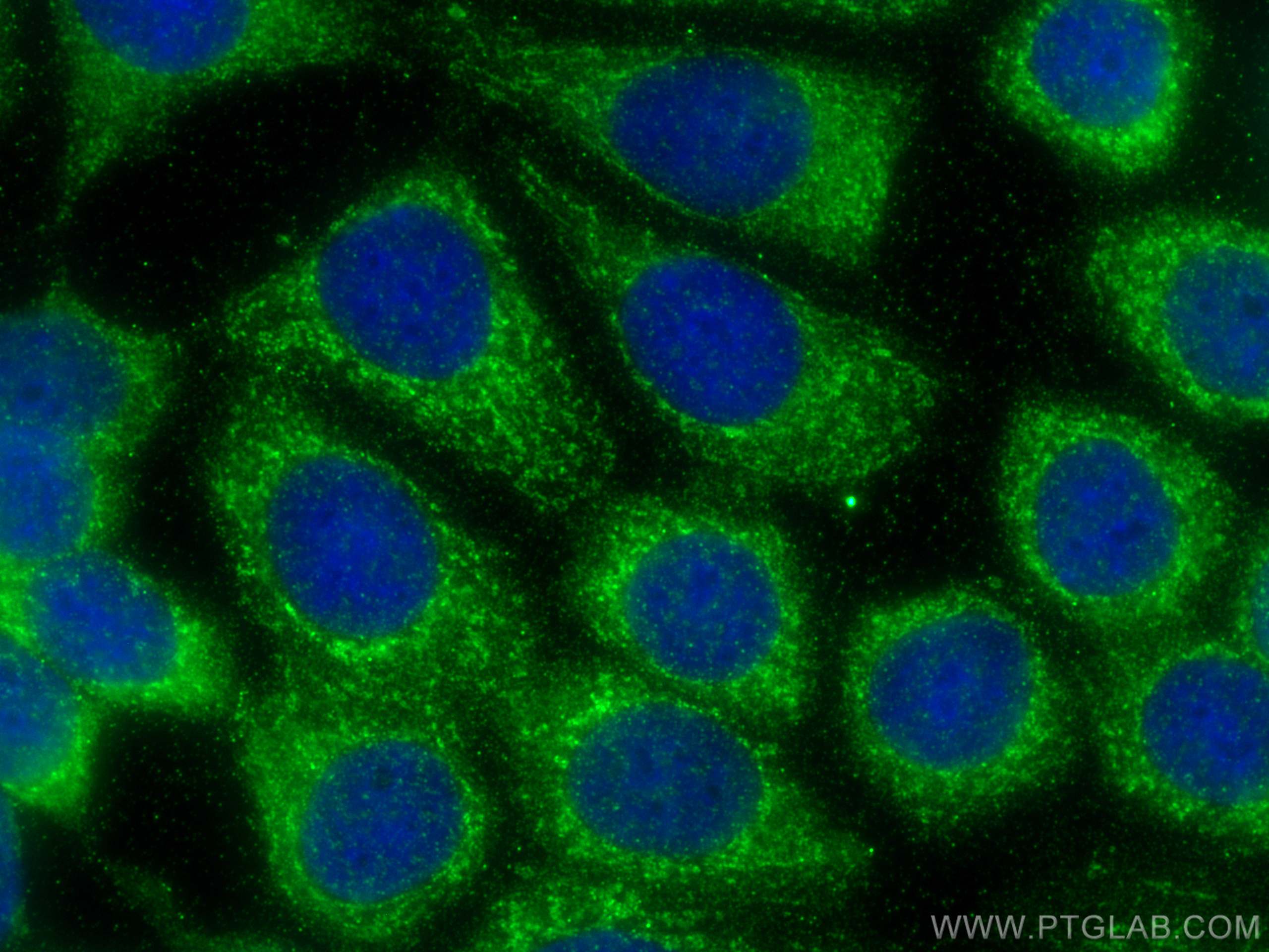 IF Staining of MCF-7 using 12411-1-AP