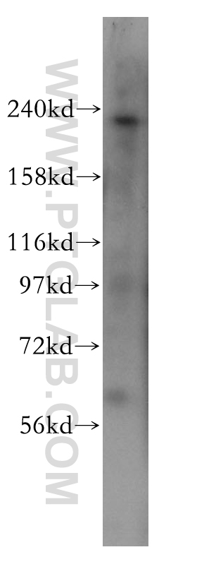 PI4KA Polyclonal antibody