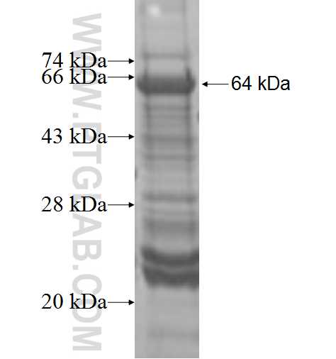 PI4KAP2 fusion protein Ag9619 SDS-PAGE PI4KAP2 fusion protein Ag9619 SDS-PAGE