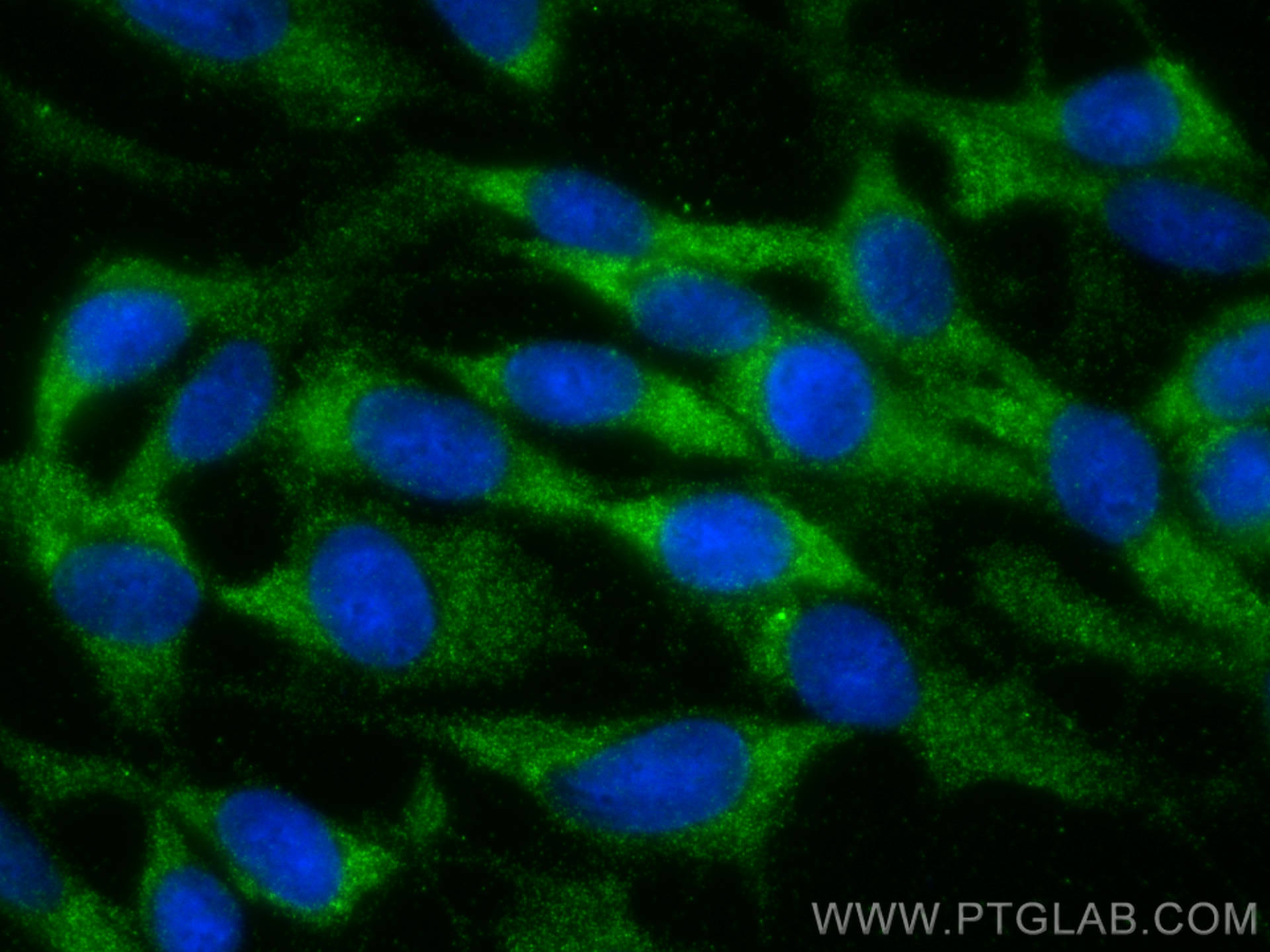 IF Staining of C6 using 13247-1-AP