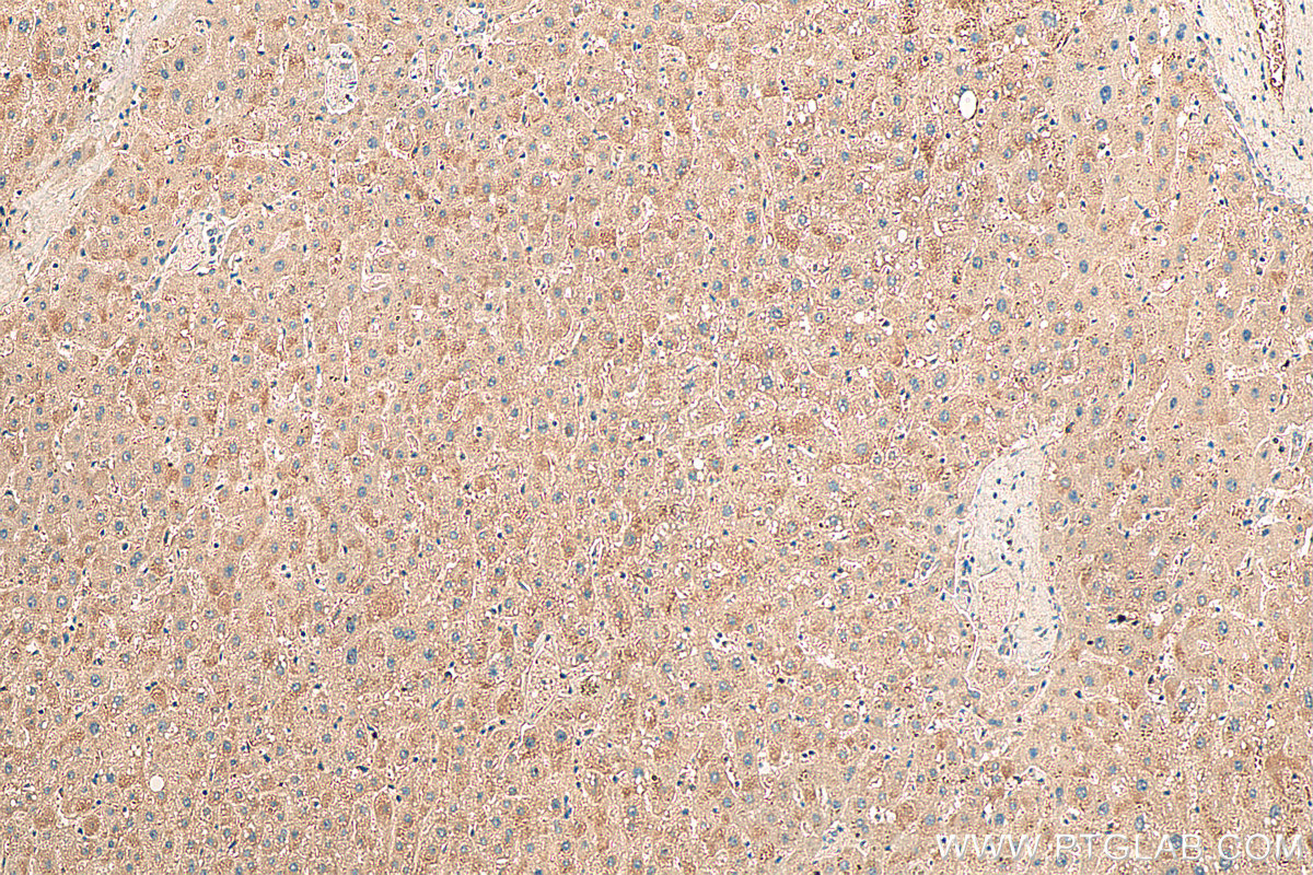 IHC staining of human liver using 13247-1-AP