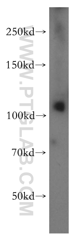 WB analysis of K-562 using 13247-1-AP