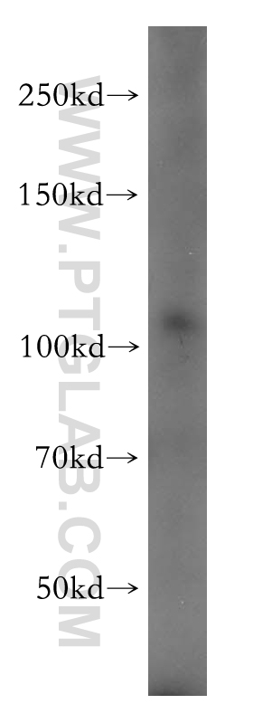 PI4KB