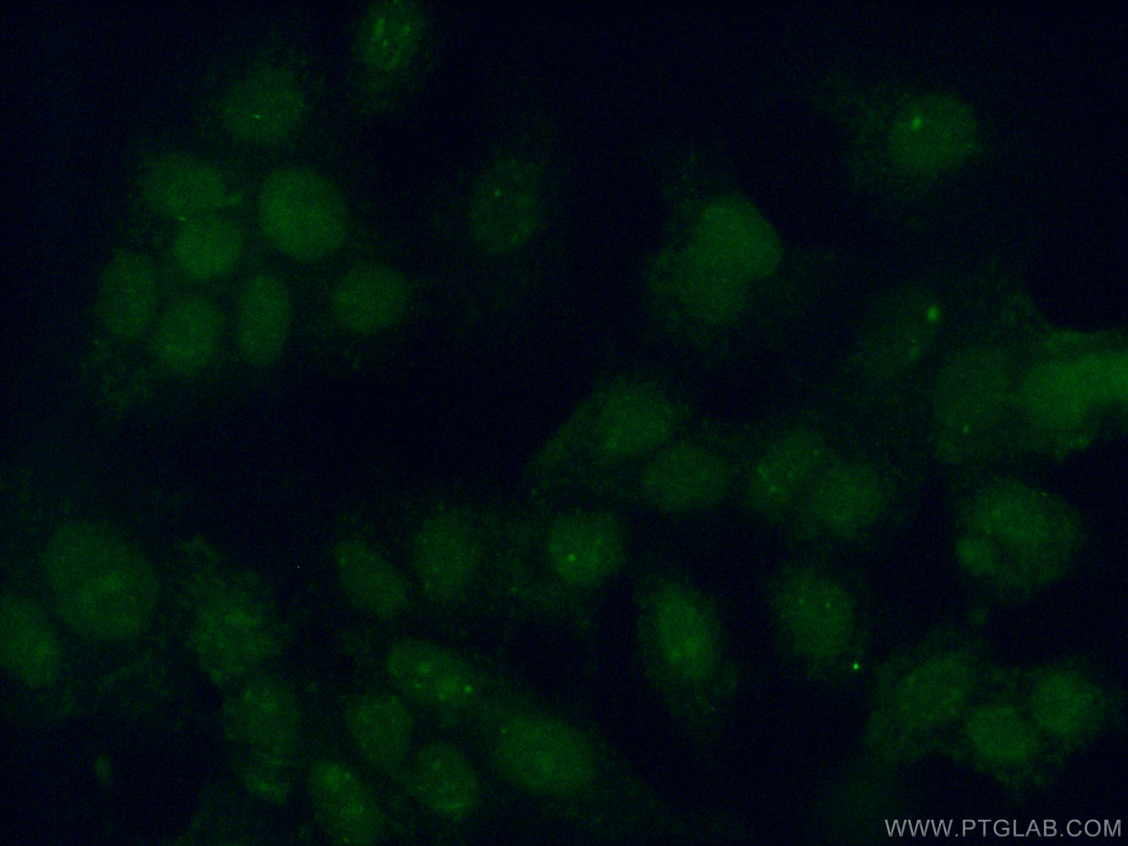 IF Staining of MCF-7 using 16074-1-AP