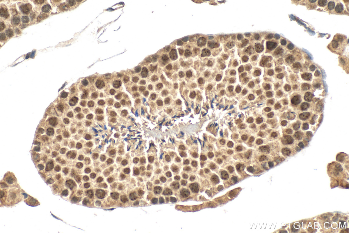 IHC staining of mouse testis using 16074-1-AP