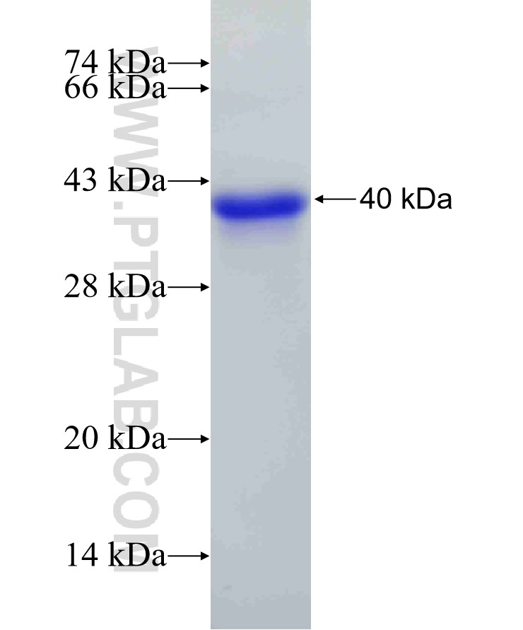 PIAS3 fusion protein Ag5774 SDS-PAGE PIAS3 fusion protein Ag5774 SDS-PAGE