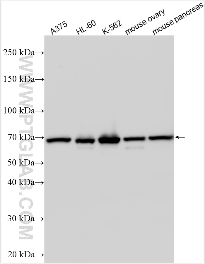WB analysis using 14242-1-AP