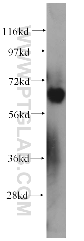 WB analysis of K-562 using 14242-1-AP