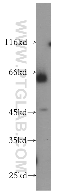 WB analysis of HL-60 using 18469-1-AP