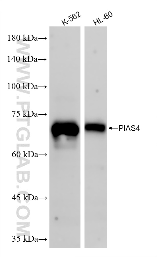 WB analysis using 86793-1-RR