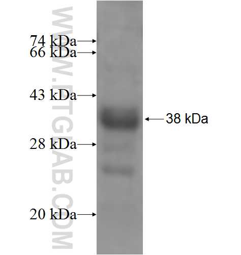 PIAS4 fusion protein Ag5498 SDS-PAGE