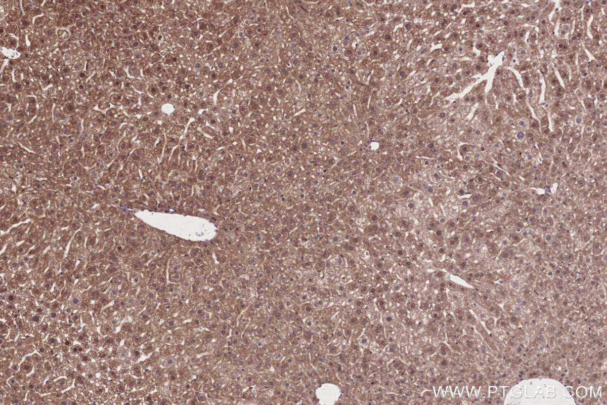 IHC staining of mouse liver using 14413-1-AP