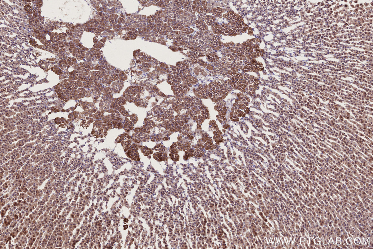 IHC staining of rat adrenal gland using 14413-1-AP