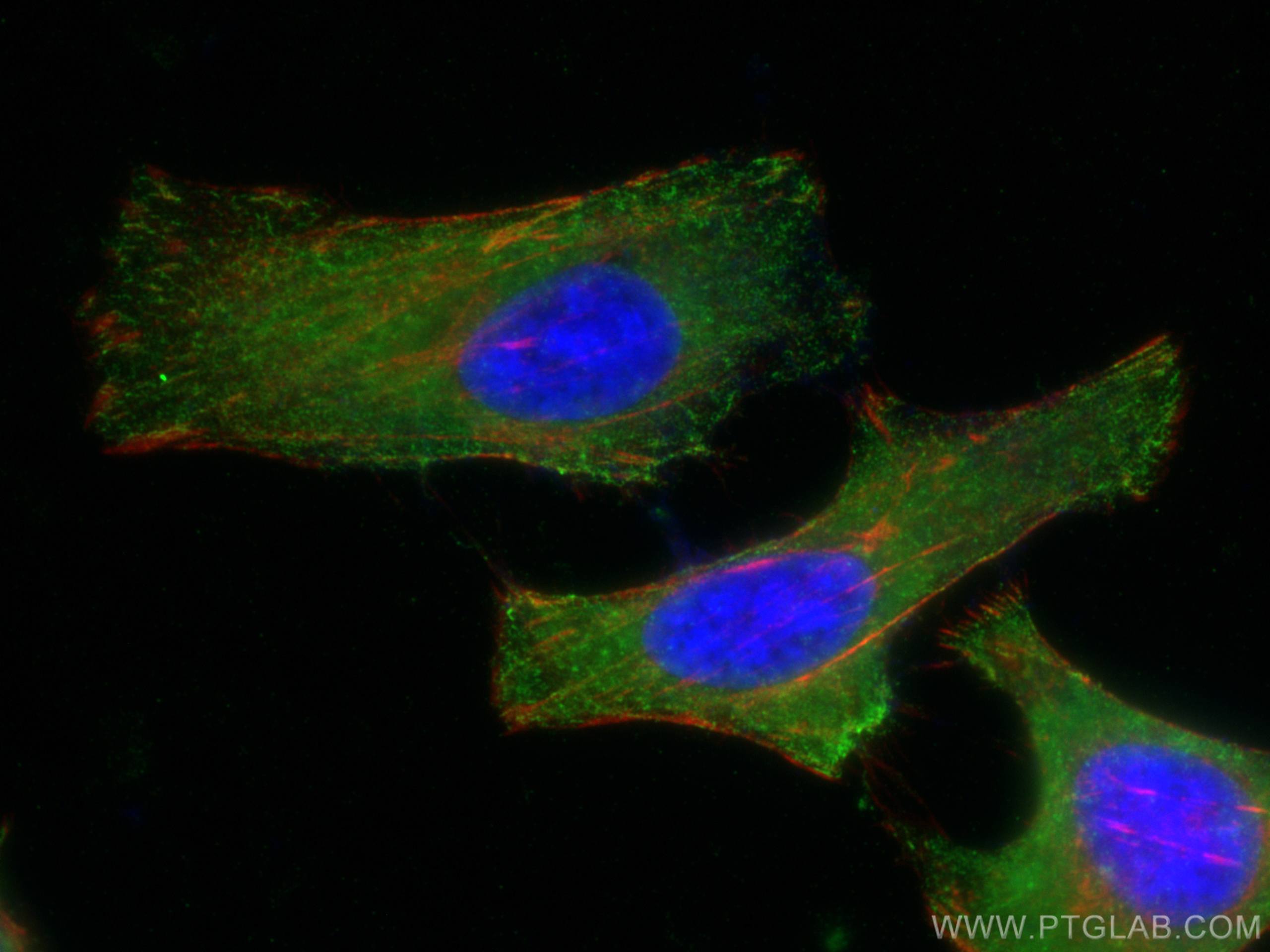 IF Staining of HeLa using 67564-1-Ig (same clone as 67564-1-PBS)