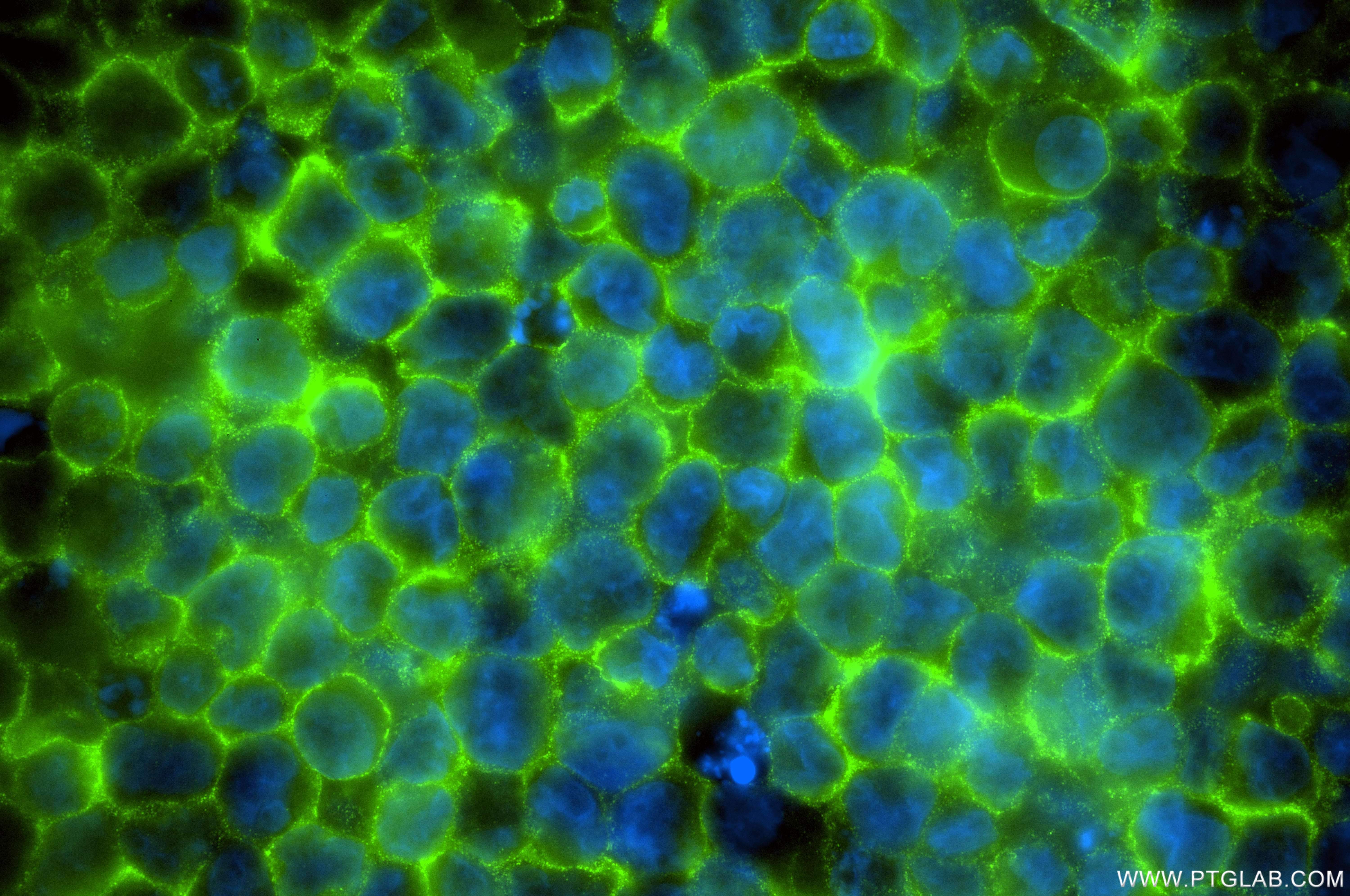 IF Staining of K-562 using 87344-1-RR