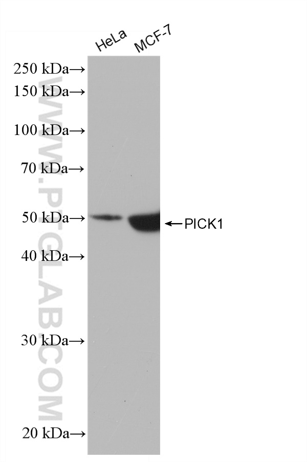 WB analysis using 82919-1-RR (same clone as 82919-1-PBS)
