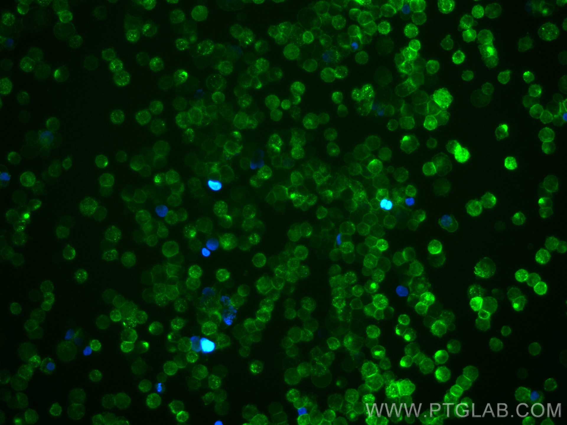 IF Staining of THP-1 using 28511-1-AP