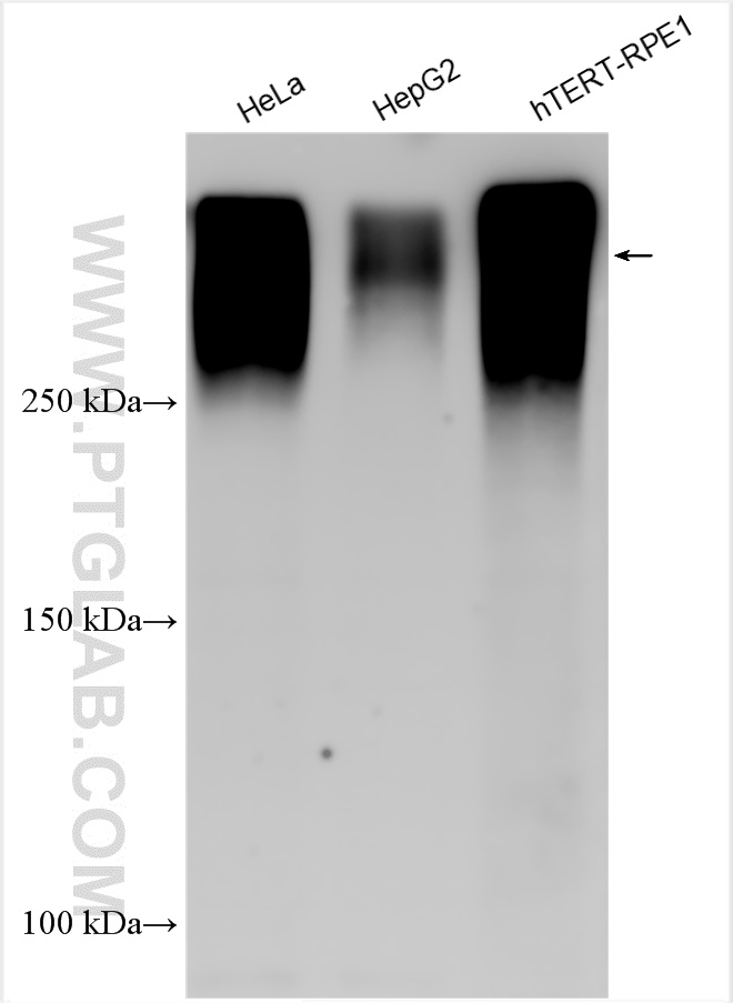 WB analysis using 28511-1-AP