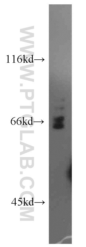 WB analysis of mouse thymus using 19006-1-AP (same clone as 19006-1-PBS)