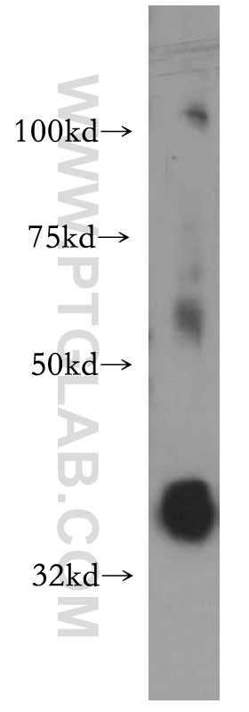 WB analysis of HeLa using 13679-1-AP