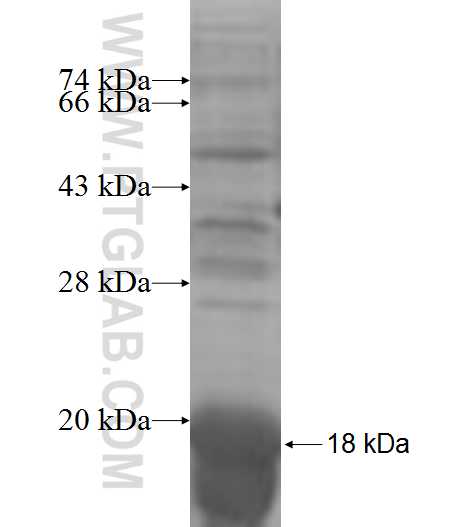 PIGH fusion protein Ag7657 SDS-PAGE PIGH fusion protein Ag7657 SDS-PAGE