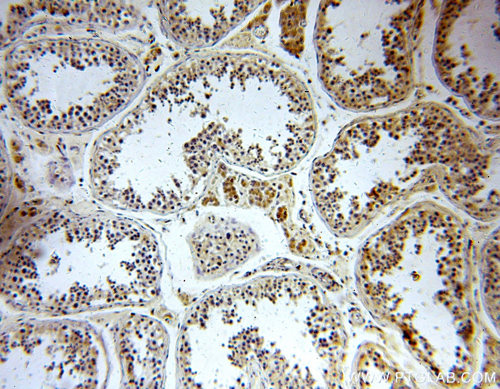 IHC staining of human testis using 20421-1-AP