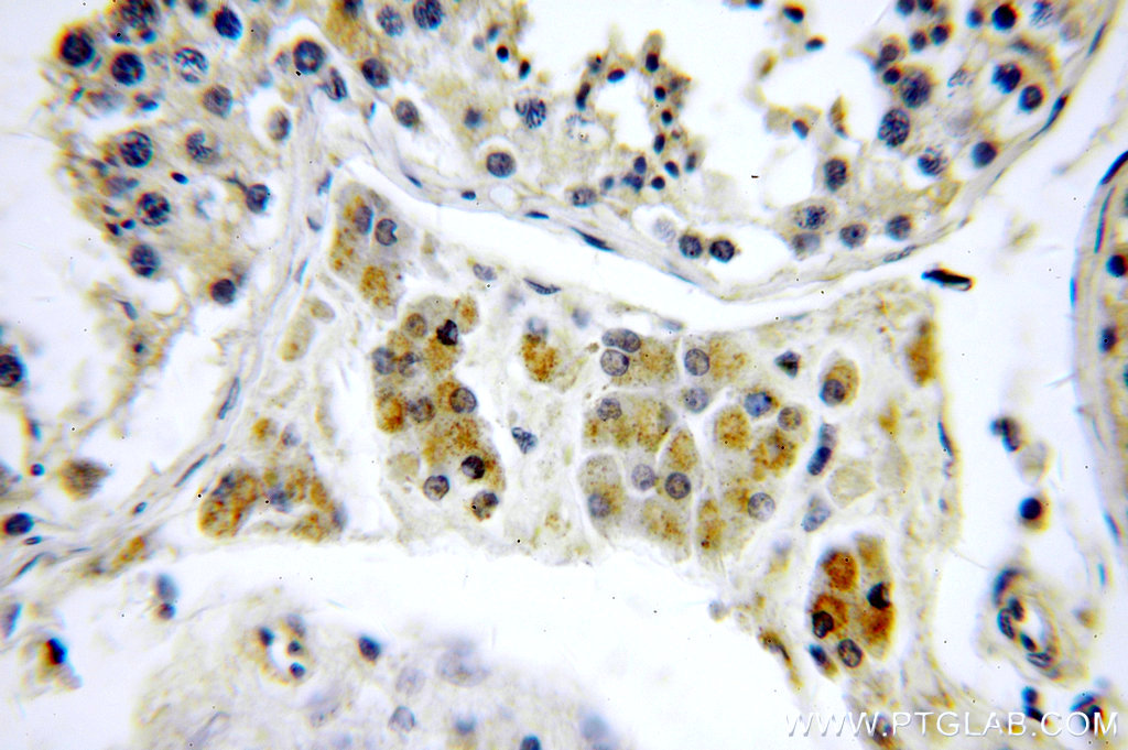 IHC staining of human testis using 20421-1-AP