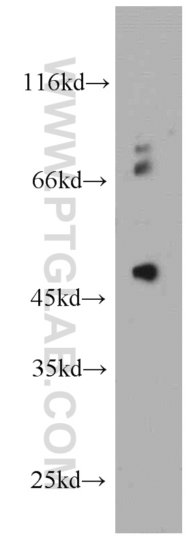 WB analysis of HeLa using 20421-1-AP