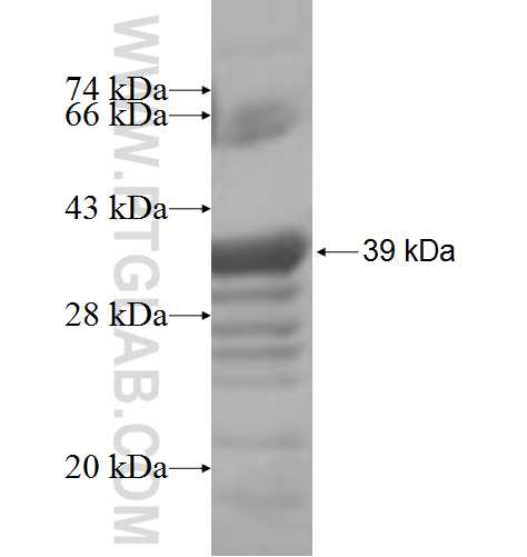 PIGN fusion protein Ag5412 SDS-PAGE PIGN fusion protein Ag5412 SDS-PAGE