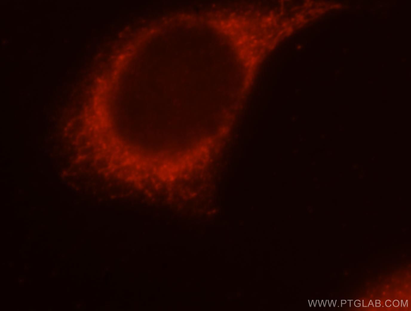 IF Staining of MCF-7 using 16369-1-AP