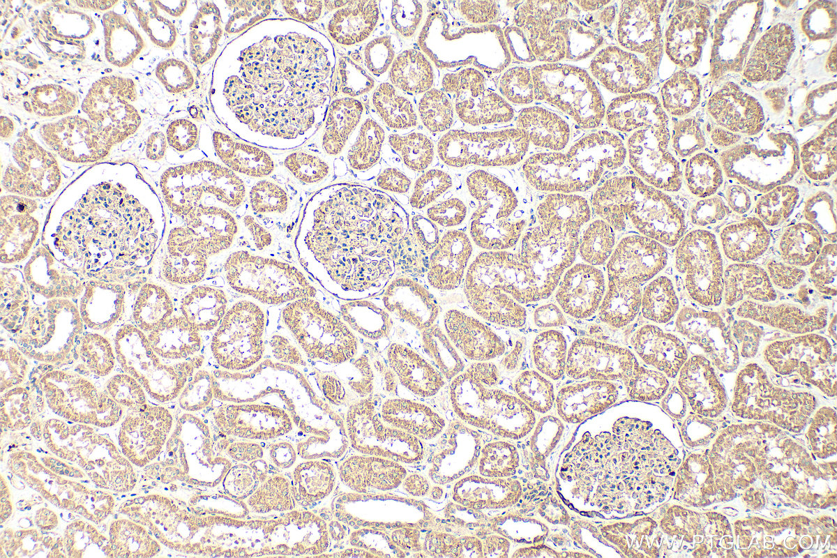 IHC staining of human kidney using 16369-1-AP