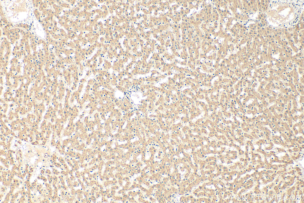IHC staining of human liver using 16369-1-AP