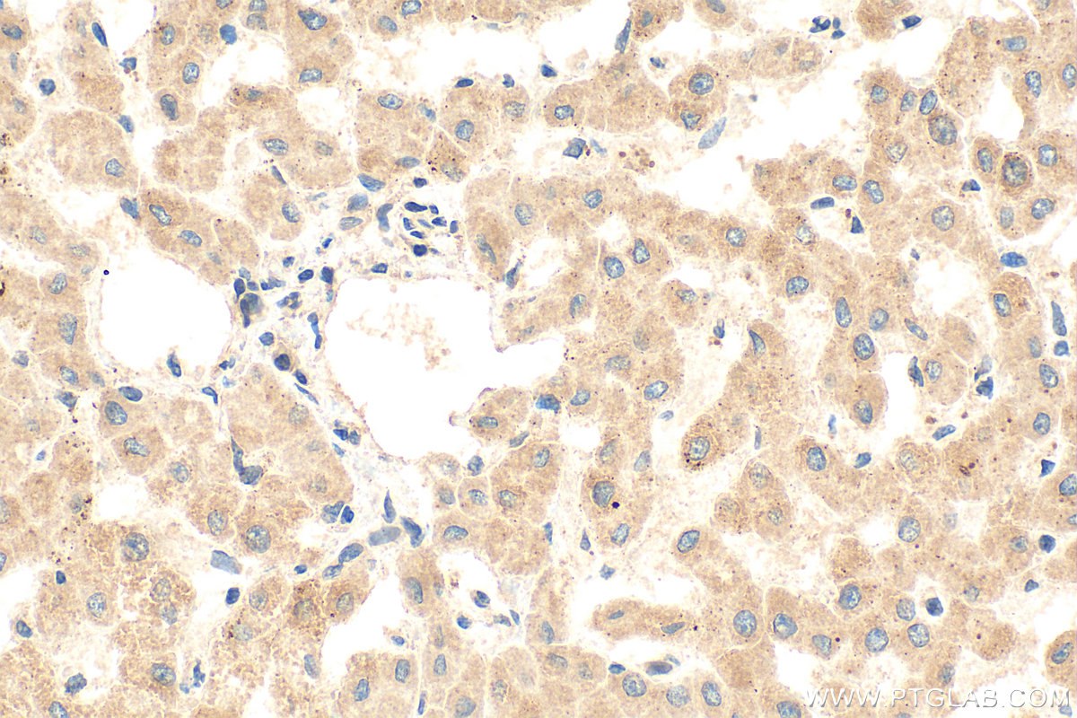 IHC staining of human liver using 16369-1-AP
