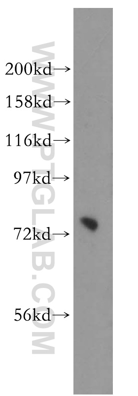 WB analysis of HeLa using 16369-1-AP