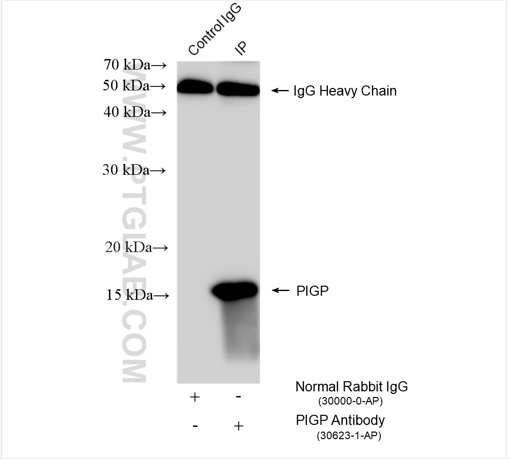 IP experiment of U-87 MG using 30623-1-AP