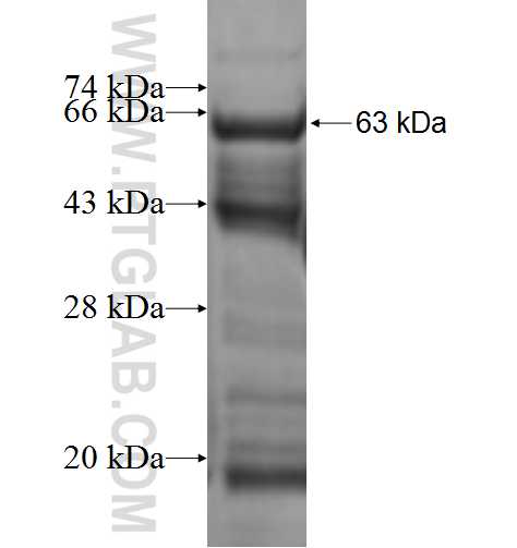 PIGQ fusion protein Ag0927 SDS-PAGE PIGQ fusion protein Ag0927 SDS-PAGE