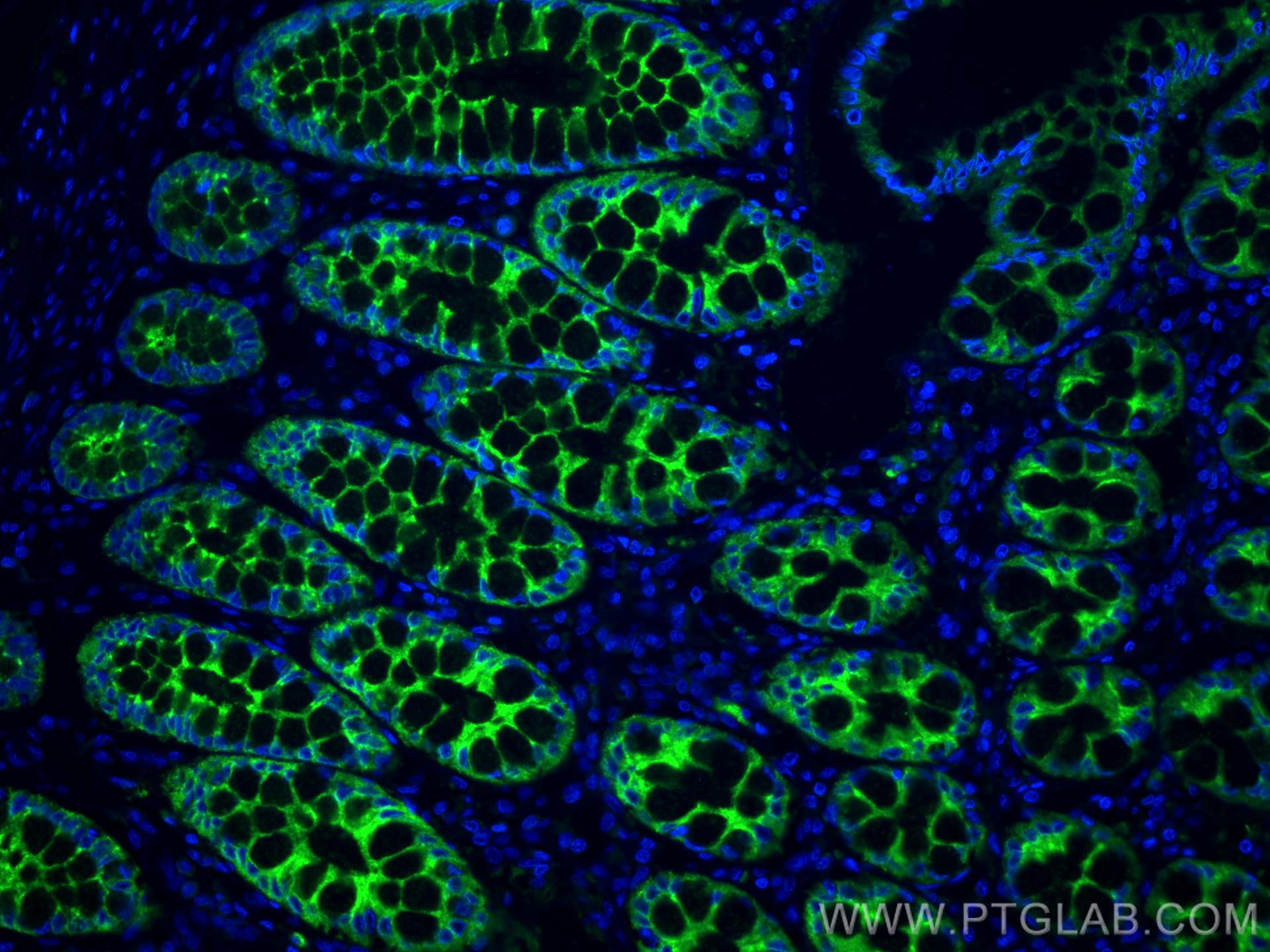 IF Staining of human small intestine using 22024-1-AP