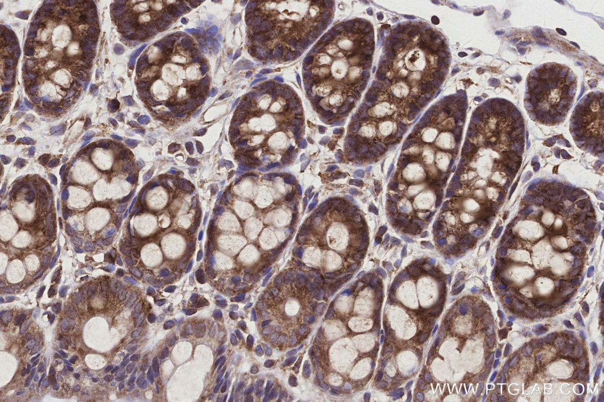 IHC staining of rat colon using 22024-1-AP IHC staining of rat colon using 22024-1-AP