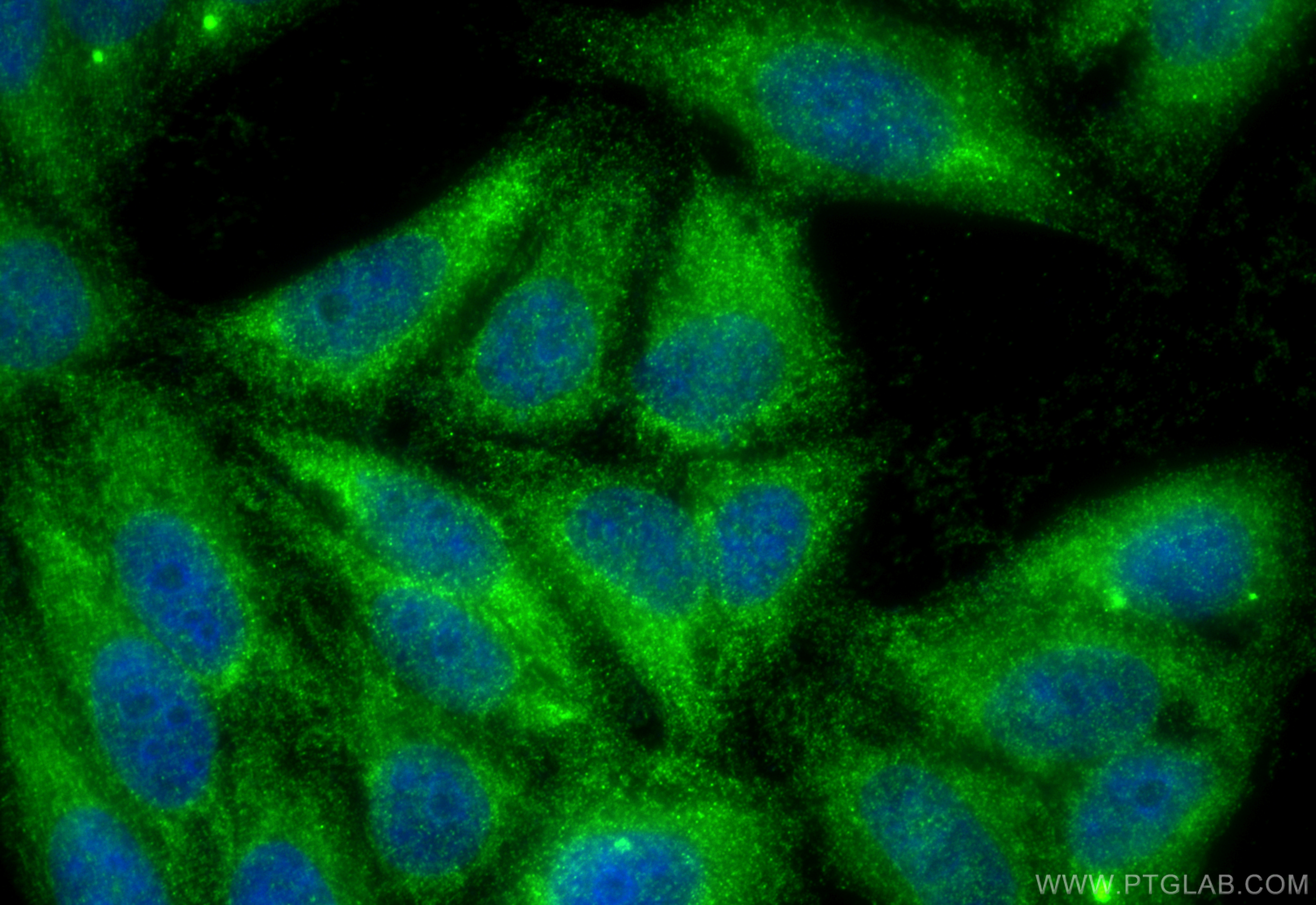 IF Staining of HepG2 using 18334-1-AP