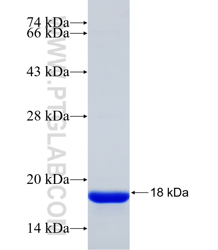 PIGT fusion protein Ag31351 SDS-PAGE