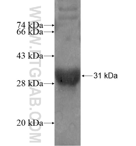 PIGX fusion protein Ag10825 SDS-PAGE