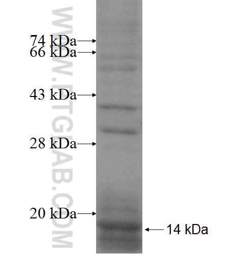 PIGY fusion protein Ag8359 SDS-PAGE PIGY fusion protein Ag8359 SDS-PAGE