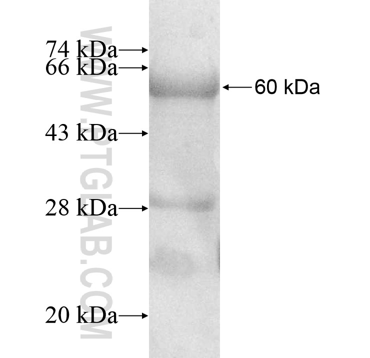 PIGZ fusion protein Ag10969 SDS-PAGE PIGZ fusion protein Ag10969 SDS-PAGE