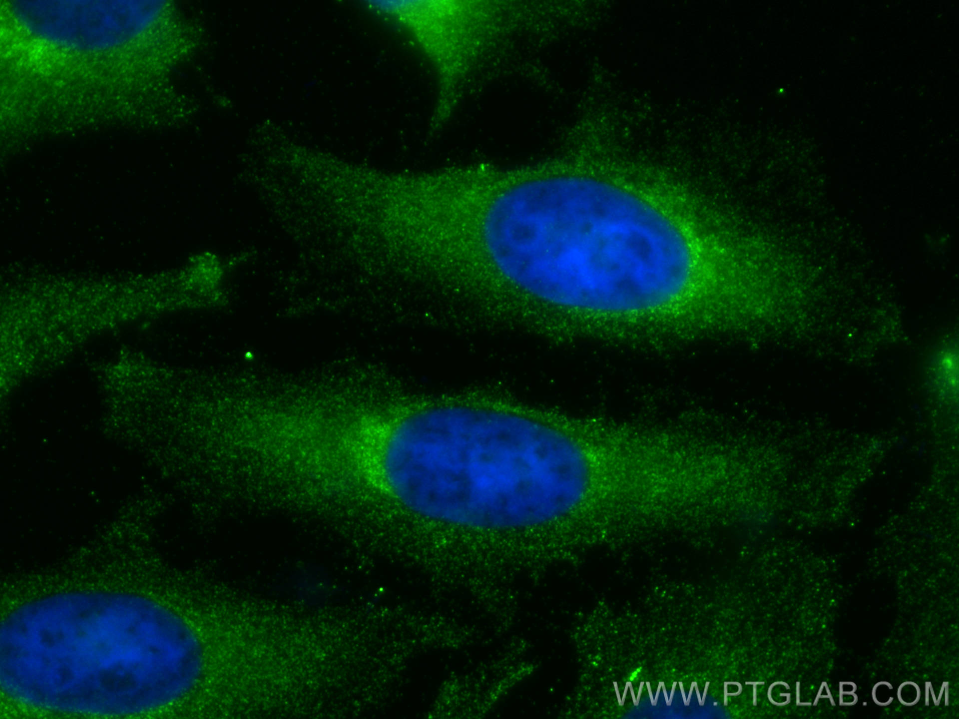 IF Staining of HeLa using 22028-1-AP