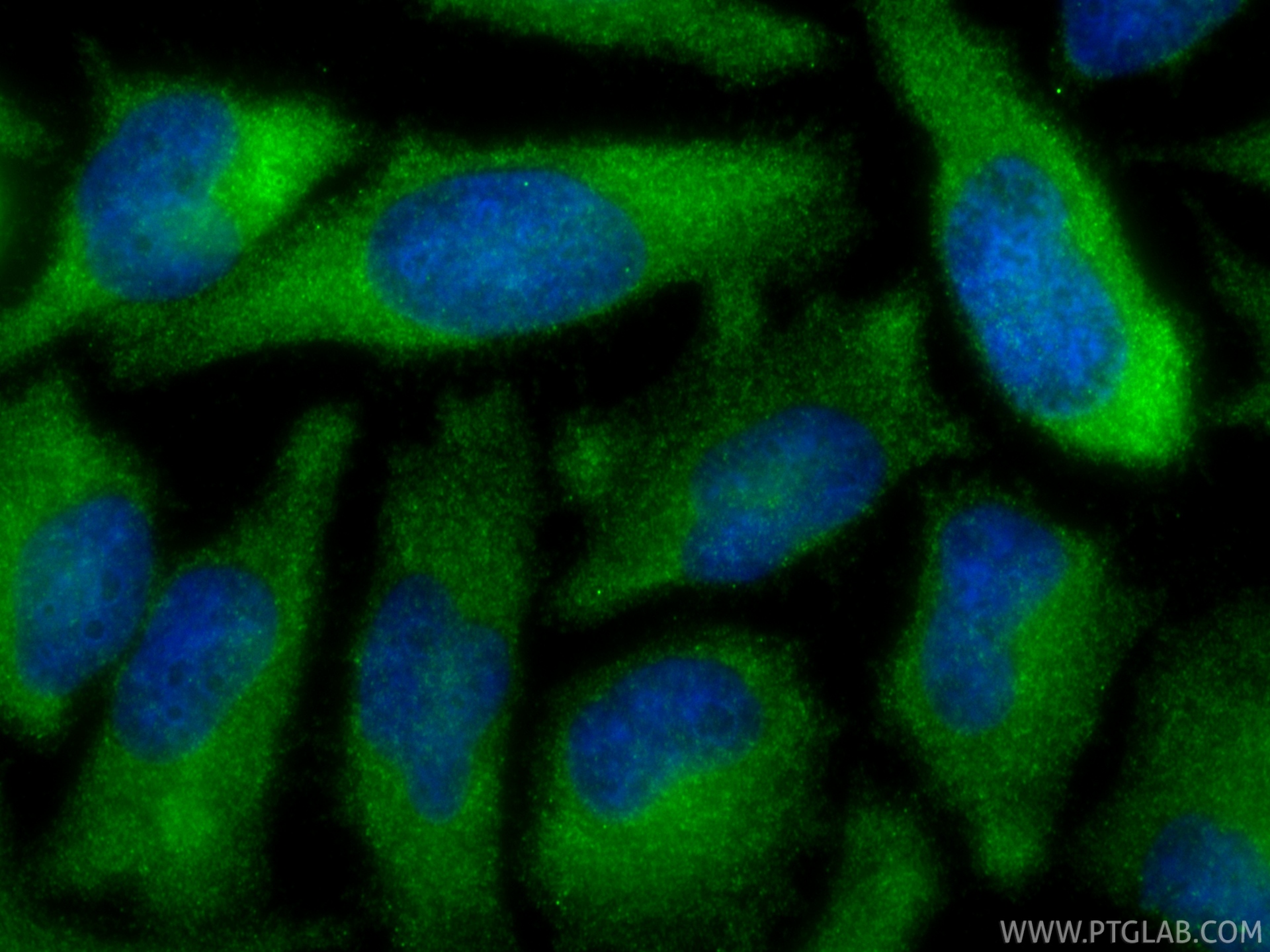 IF Staining of HeLa using 88380-1-RR IF Staining of HeLa using 88380-1-RR