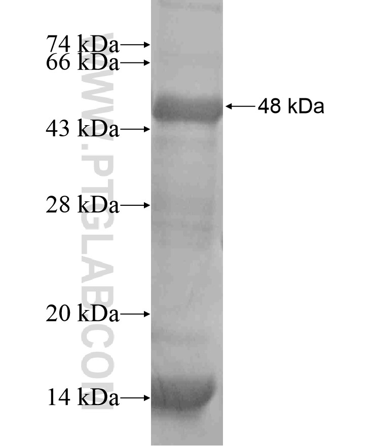 PIK3C2A fusion protein Ag17627 SDS-PAGE PIK3C2A fusion protein Ag17627 SDS-PAGE
