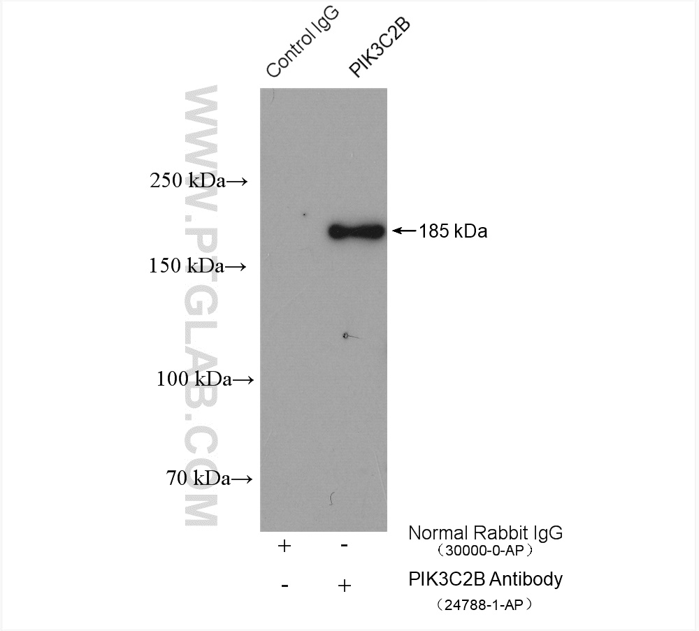 IP experiment of HeLa using 24788-1-AP