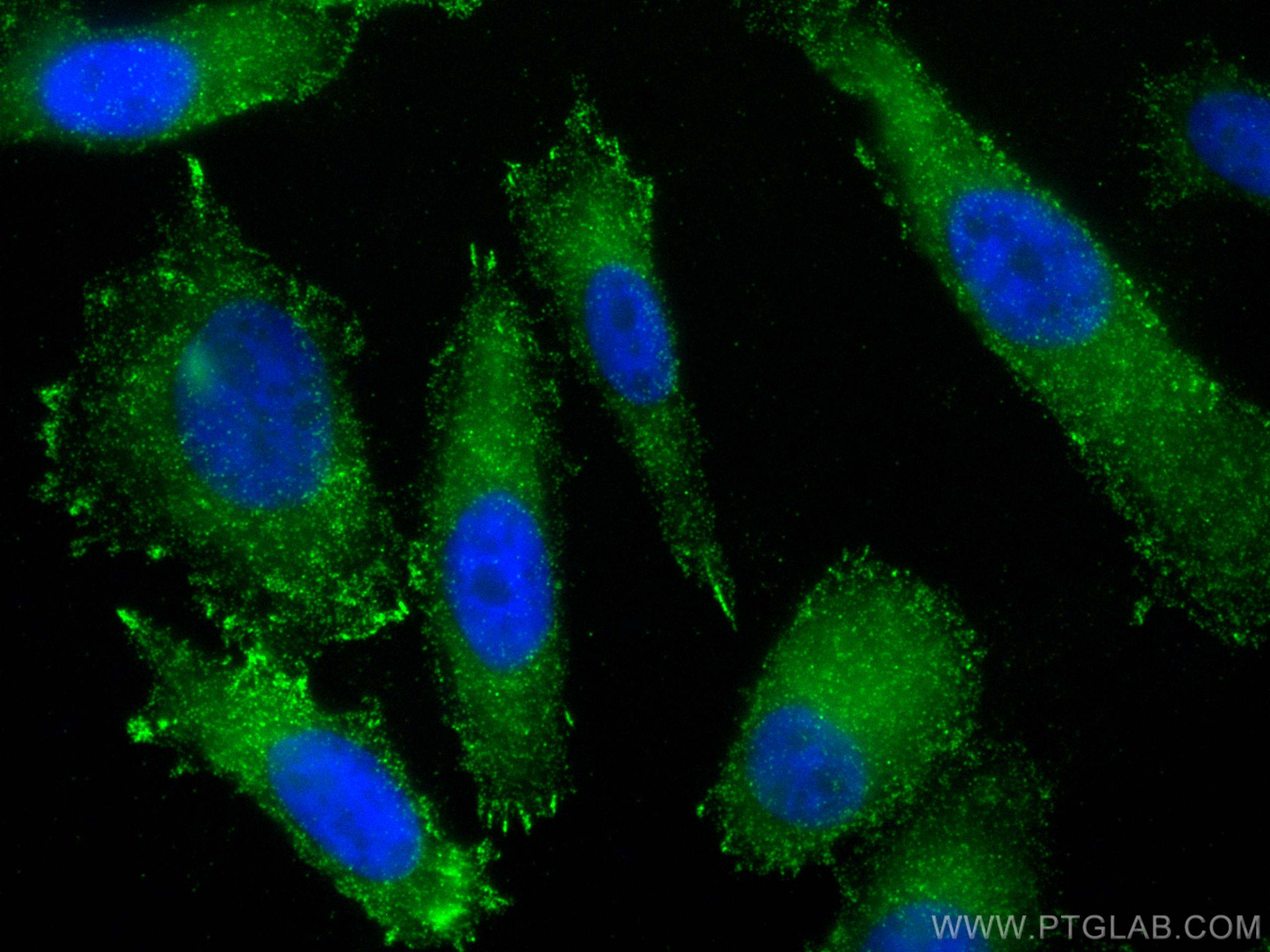 IF Staining of PC-3 using 12452-1-AP