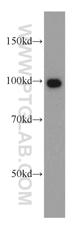 WB analysis of PC-3 using 12452-1-AP